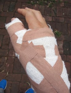 My wrapped up hand.
